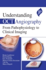 Image for Understanding OCT Angiography