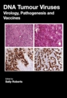 Image for DNA tumour viruses: virology, pathogenesis and vaccines