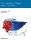 Image for Understanding Liver Cancer : A Tale of Two Diseases