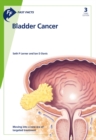 Image for Fast Facts: Bladder Cancer