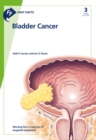 Image for Bladder cancer.