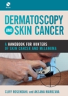 Image for Dermatoscopy and skin cancer  : a handbook for hunters of skin cancer and melanoma