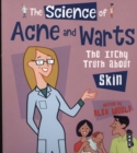 Image for The science of acne &amp; warts  : the itchy truth about skin