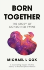 Image for Born together  : the story of conjoined twins