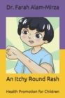 Image for An Itchy Round Rash
