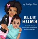 Image for Blue Bums : The truth about mixed race babies, from a mixed race baby