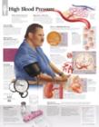 Image for High Blood Pressure Laminated Poster