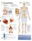 Image for Osteoarthritis Laminated Poster
