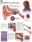 Image for Middle Ear Infections Laminated Poster