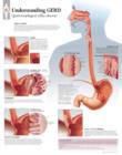 Image for Understanding GERD (Gastroesophageal Reflux Disease) Laminated Poster