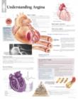 Image for Understanding Angina Laminated Poster