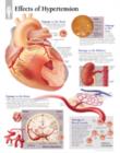 Image for Effects of Hypertension Laminated Poster