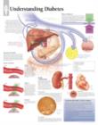 Image for Understanding Diabetes Laminated Poster