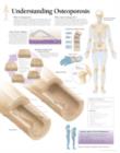 Image for Understanding Osteoporosis Paper Poster