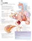 Image for COPD (Chronic Obstructive Pulmonary Disease) Paper Poster