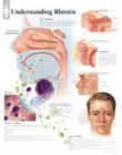 Image for Understanding Rhinitis Paper Poster