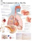 Image for Understanding the Common Cold Laminated Poster