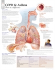 Image for COPD &amp; Asthma Laminated Poster