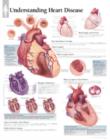 Image for Understanding Heart Disease Laminated Poster