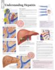 Image for Understanding Hepatitis Laminated Poster