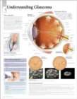 Image for Understanding Glaucoma Laminated Poster