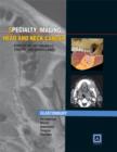 Image for Specialty Imaging: Head &amp; Neck Cancer