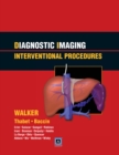 Image for Interventional procedures
