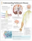 Image for Understanding Parkinson&#39;s Laminated Poster