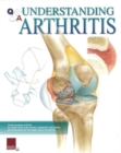 Image for Understanding Arthritis Flip Chart