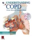 Image for Understanding COPD Flip Chart