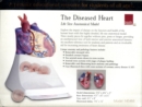 Image for Life Size Diseased Heart Model