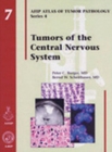 Image for Tumors of the Central Nervous System