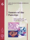 Image for Tumors of the Pancreas