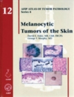 Image for Melanocytic Tumors of the Skin