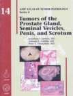 Image for Tumors of the Prostate Gland, Seminal Vesicles, Penis, and Scrotum