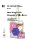 Image for Non-neoplastic diseases of the liver