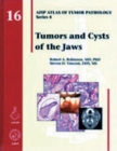 Image for Tumors and Cysts of the Jaws