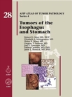 Image for Tumors of the esophagus and stomach