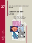 Image for Tumors of the liver