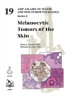 Image for Melanocytic Tumors of Skin