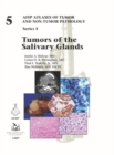 Image for Tumors of the Salivary Glands
