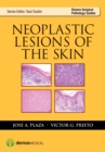 Image for Neoplastic Lesions of the Skin