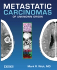 Image for Metastatic Carcinomas of Unknown Origin