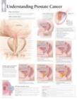 Image for Understanding Prostate Cancer Laminated Poster