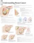 Image for Understanding Breast Cancer Laminated Poster