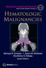 Image for Hematologic Malignancies