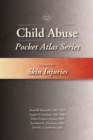 Image for Child Abuse Pocket Atlas Series, Volume 1: Skin Injuries