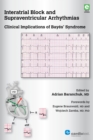 Image for Interatrial Block and Supraventricular Arrhythmias: Clinical Implications of Bayes&#39; Syndrome