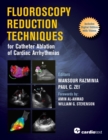 Image for Fluoroscopy Reduction Techniques for Catheter Ablation of Cardiac Arrhythmias.