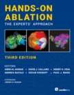 Image for Hands-on Ablation: The Experts&#39; Approach